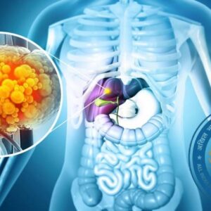 Fatty Liver को लेकर AIIMS के डॉक्टरों ने क्यों दी चेतावनी?