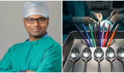 महिला के पेट में 13 पेन, 5 लकड़ी के चम्मच और मोमबत्ती... आखिर ये सब पेट में पहुंचे कैसे?